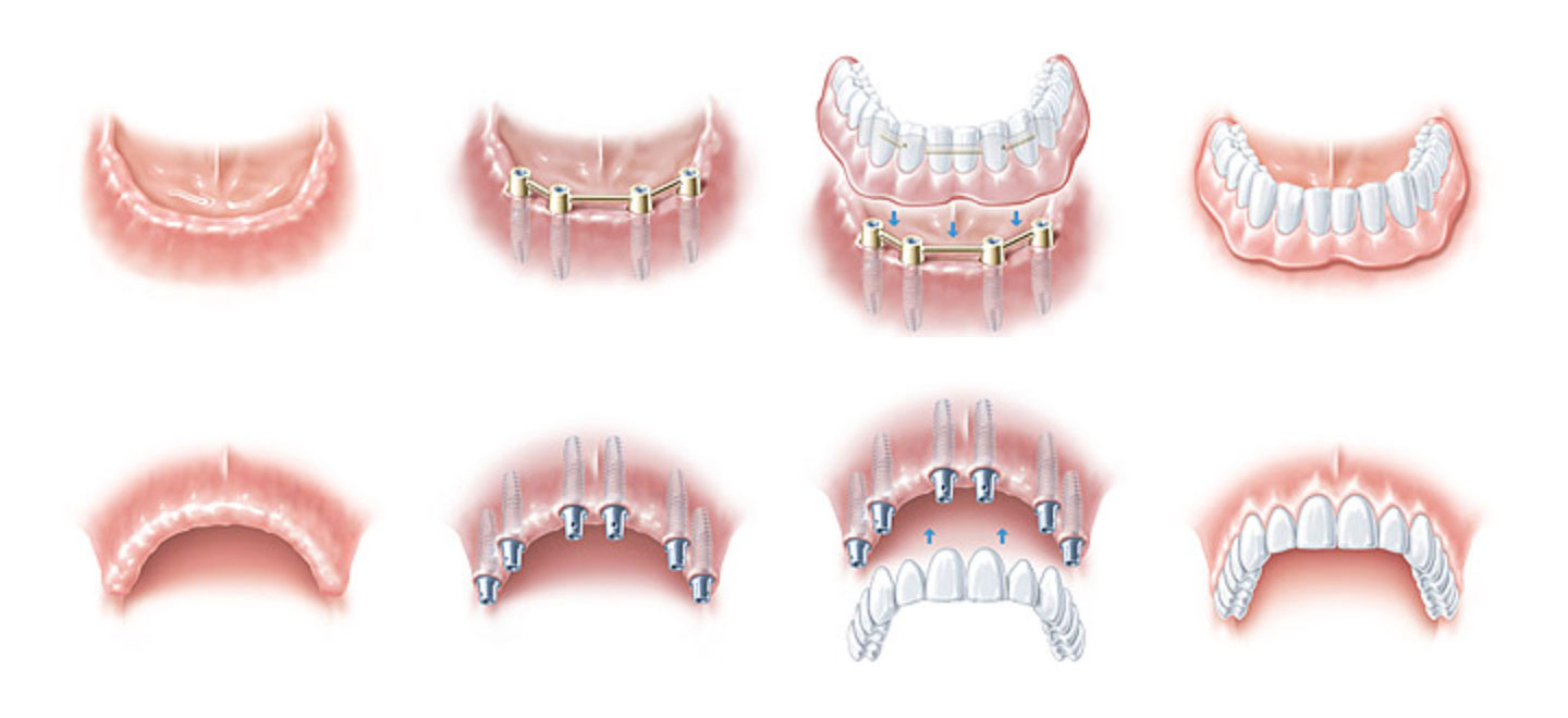 Focus Dental